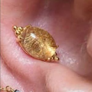 Anatometal Farata Threadless pin end.